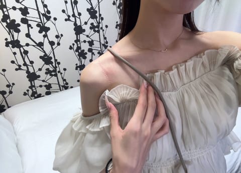なんか伸びた投稿は斜め掛けバックの痕撮るための写真だったりした👈🏻