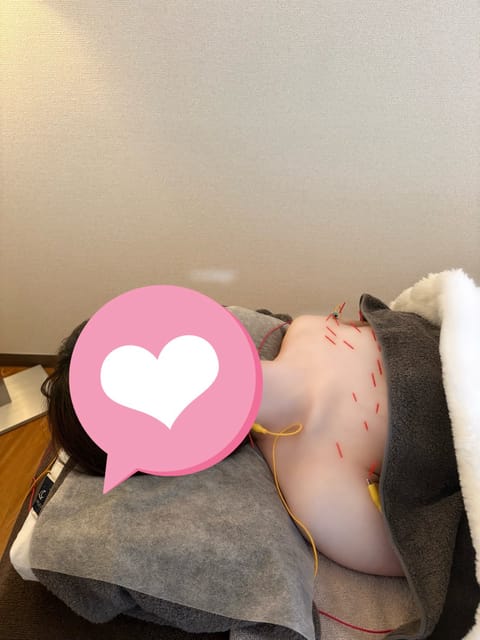 藤原あやです🌹
しばらく出勤お休み中ですが、美容メンテナンスはぬかりなく🫶

美容鍼でお顔や身体をしっかり引き締めてきま