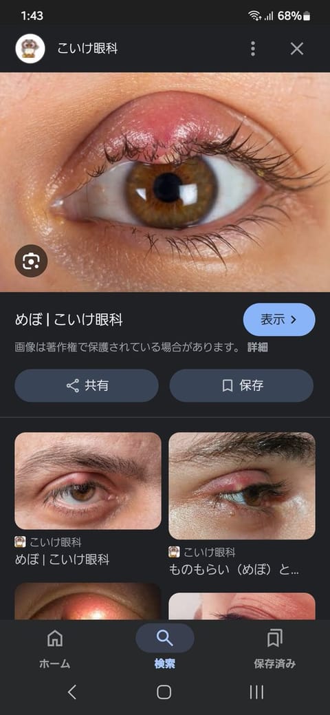 ものもらいどんどん
悪化してしまったので
少しお休み頂くことになりました💦

これは拾い画だけど、
今こんな感じになって