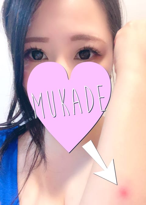 【悲報】
りっちゃん、ムカデに噛まれる。笑

山に住む者の運命というか…

山暮らしの民なら分かるはず🥹

マダニ、ムカ
