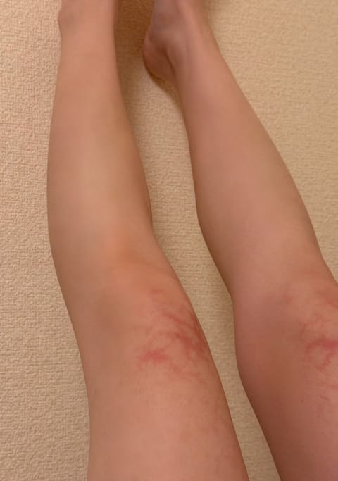 🤩
夏だ❗️🤩←最近の私【dpgk】

最近元気すぎて髪を金髪にしてしまいました。驚かせてすみません❗️🤩

サウナ週3