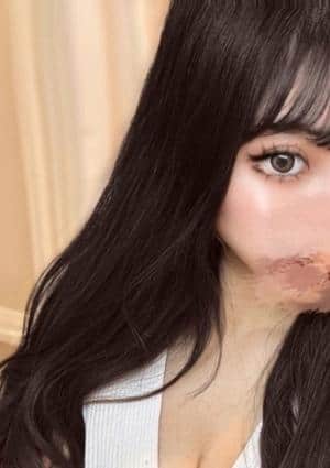 ルナ